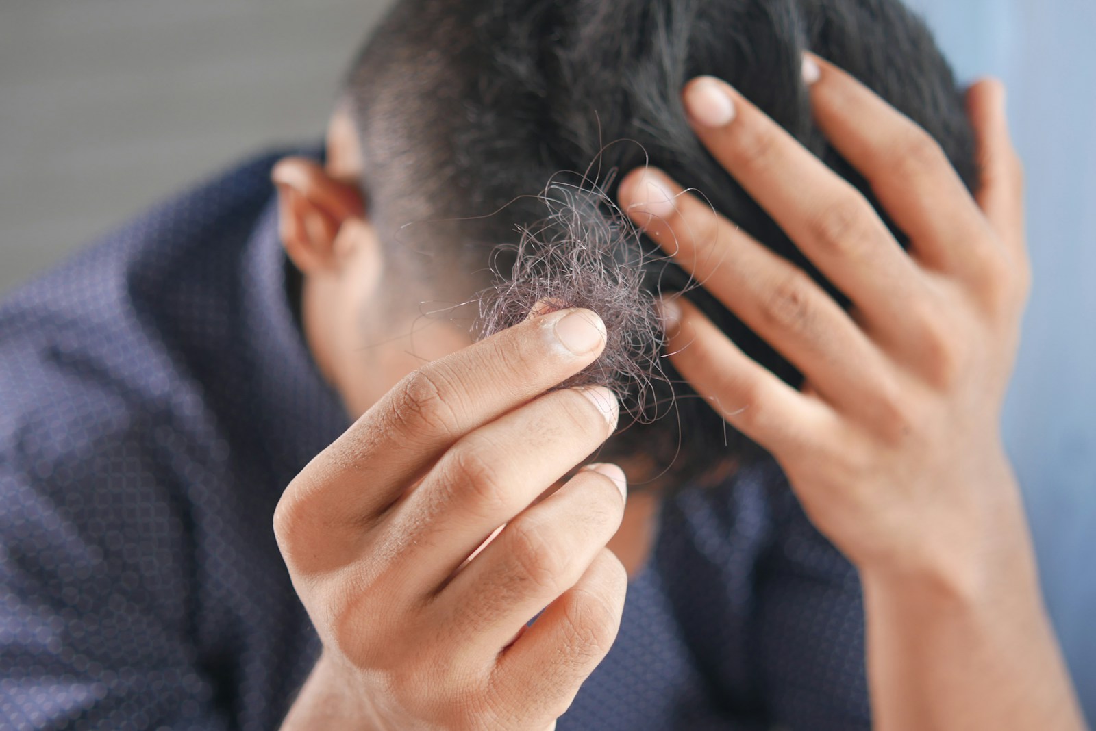 A hand holding strands of shed hair