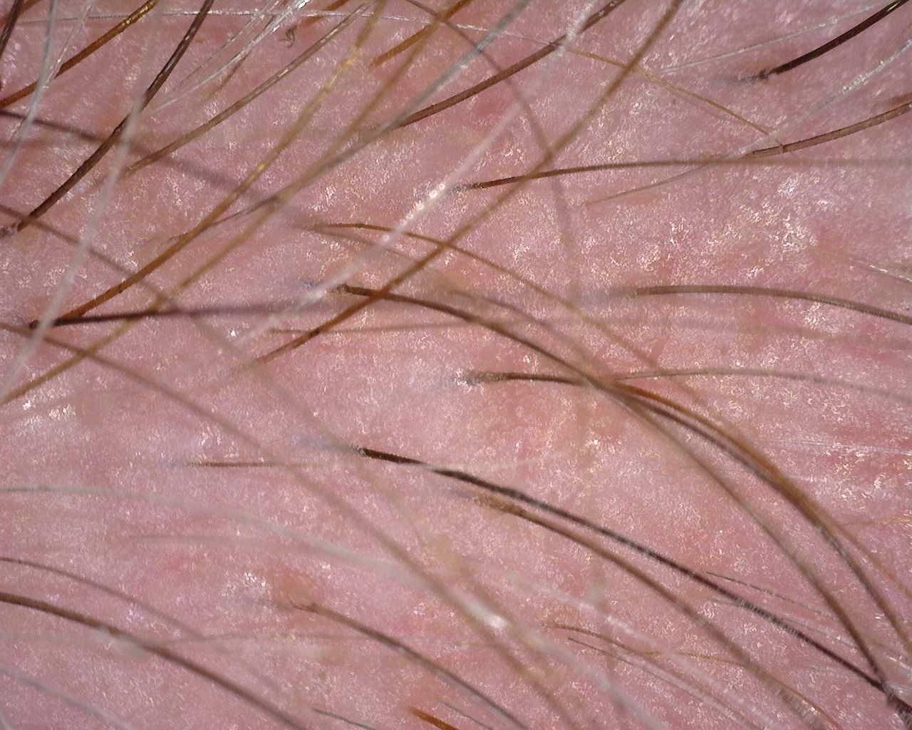 TricoTest image of the scalp surface at 50 times, used to judge dryness and moisture balance